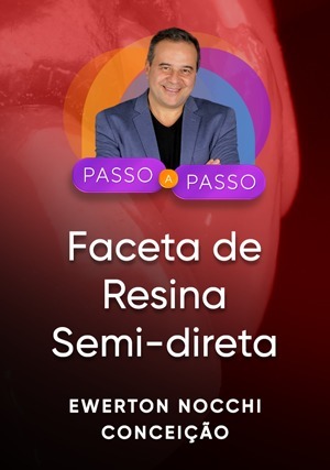 Cover for Passo a Passo Clínico: Faceta de Resina Semi-direta