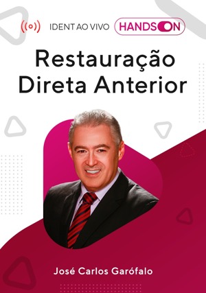 Cover for Hands On: Restauração Direta Anterior em Dente Escurecido