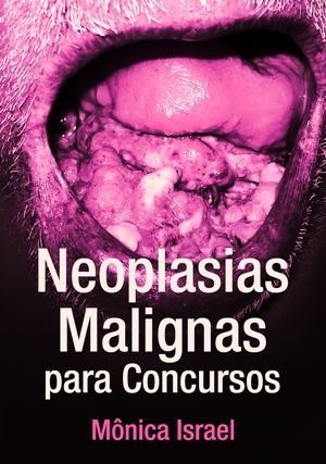 Cover for Neoplasias Malignas para Concursos