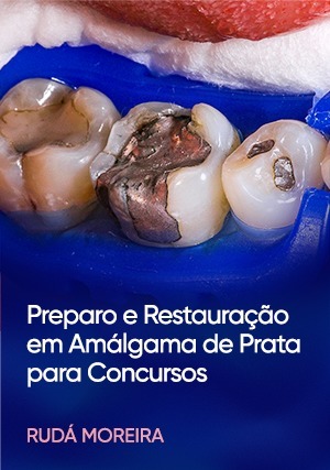 Cover for Preparo e Restauração em Amálgama de Prata para Concursos