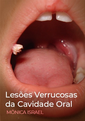 Cover for Lesões Verrucosas da Cavidade Oral