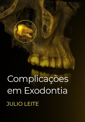 Cover for Complicações em Exodontia