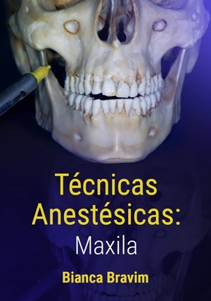 Cover for Técnicas Anestésicas: Maxila