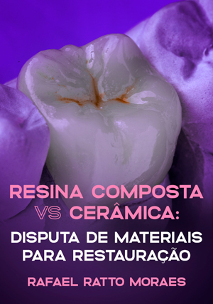 Cover for Resina Composta vs. Cerâmica: Disputa de Materiais para Restauração