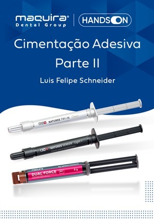 Cover for Hands On: Cimentação Adesiva - Parte II