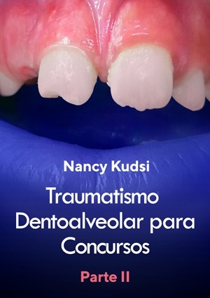 Cover for Traumatismo Dentoalveolar para Concursos: Parte II