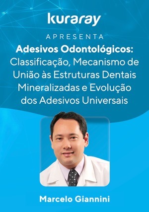 Cover for Kuraray Apresenta: Adesivos Odontológicos - Classificação, Mecanismo de União às Estruturas Dentais Mineralizadas e Evolução dos