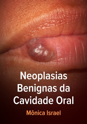 Cover for Neoplasias Benignas da Cavidade Oral