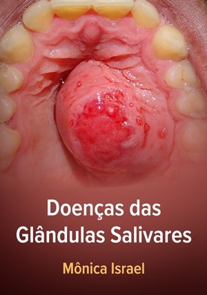 Cover for Doenças das Glândulas Salivares