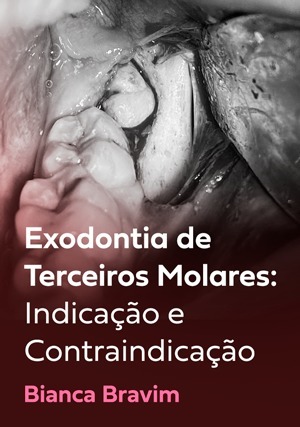Cover for Exodontia de Terceiros Molares: Indicação e Contraindicação