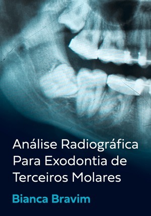 Cover for Análise Radiográfica Para Exodontia de Terceiros Molares