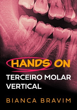 Cover for Terceiro Molar Vertical