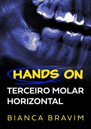 Cover for Terceiro Molar Horizontal
