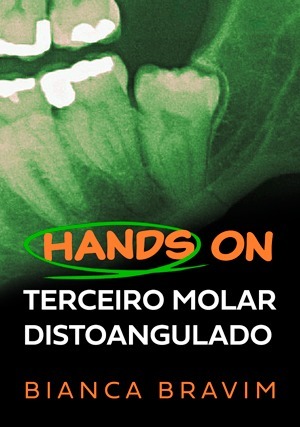Cover for Terceiro Molar Distoangulado