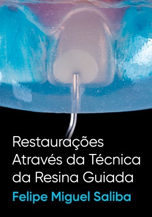 Cover for Restaurações Através da Técnica da Resina Guiada