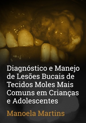Cover for Diagnóstico e Manejo de Lesões Bucais de Tecidos Moles Mais Comuns em Crianças e Adolescentes