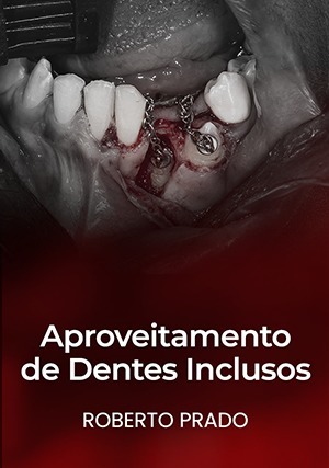 Cover for Aproveitamento de Dentes Inclusos