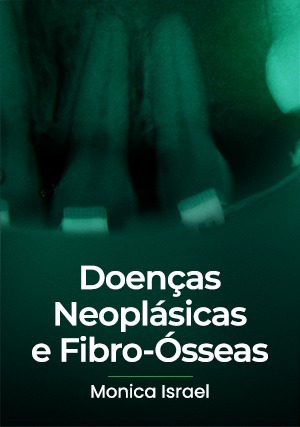 Cover for Doenças Neoplásicas e Fibro-Ósseas