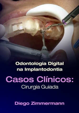 Cover for Odontologia Digital na Implantodontia: Cirurgia Guiada