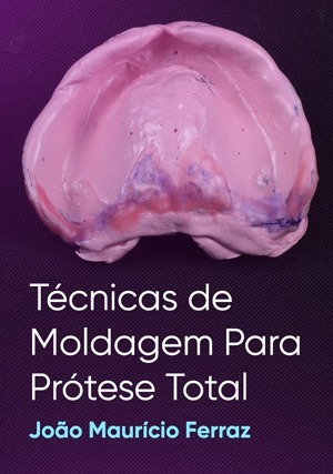 Cover for Técnicas de Moldagem Para Prótese Total