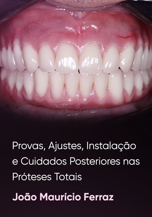 Cover for Provas, Ajustes, Instalação e Cuidados Posteriores nas Prótese Total