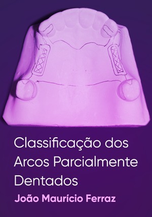 Cover for Classificação dos Arcos Parcialmente Dentados