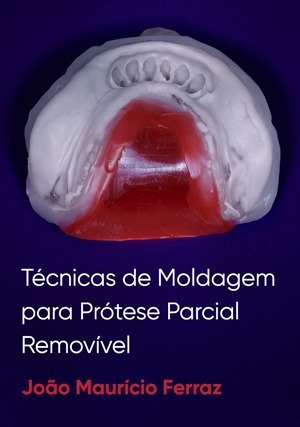 Cover for Técnicas de Moldagem para Prótese Parcial Removível