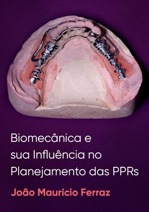 Cover for Biomecânica e sua influência no planejamento das PPRs