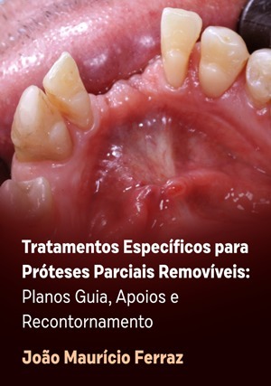 Cover for Tratamentos Específicos para Próteses Parciais Removíveis: Planos Guia, Apoios e Recontornamento