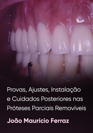 Cover for Provas, Ajustes, Instalação e Cuidados Posteriores nas Próteses Parciais Removíveis