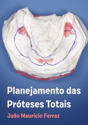 Cover for Planejamento das Próteses Totais