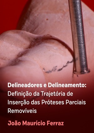 Cover for Delineadores e Delineamento: Definição da Trajetória de Inserção das Próteses Parciais Removíveis