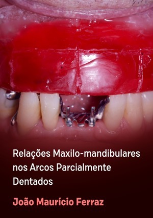 Cover for Relações Maxilo-mandibulares nos Arcos Parcialmente Dentados