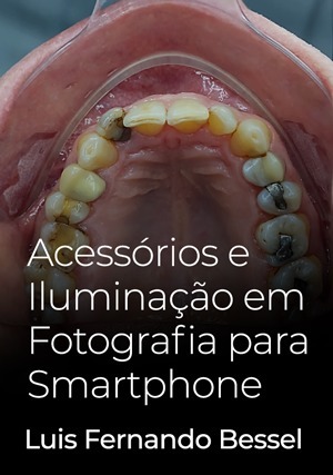 Cover for Acessórios e Iluminação em Fotografia para Smartphone