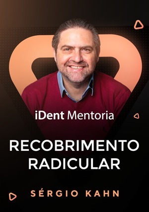Cover for iDent Mentoria: Recobrimento Radicular