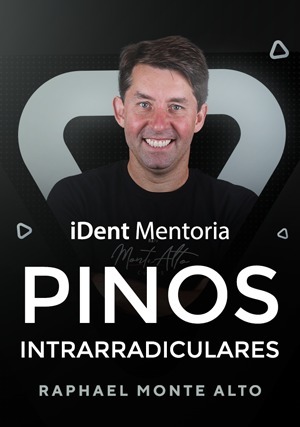 Cover for iDent Mentoria: Pinos Intrarradiculares