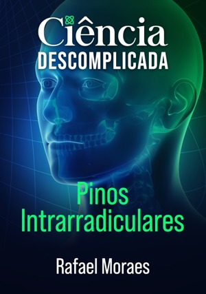 Cover for Ciência Descomplicada: Pinos Intrarradiculares