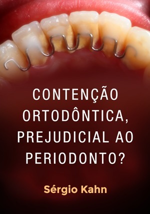 Cover for Contenção Ortodôntica, Prejudicial ao Periodonto?