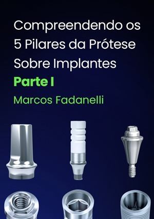 Cover for Compreendendo os 5 Pilares da Prótese Sobre Implantes: Parte I