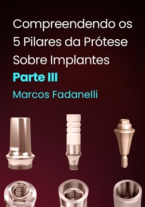 Cover for Compreendendo os 5 Pilares da Prótese Sobre Implantes: Parte III