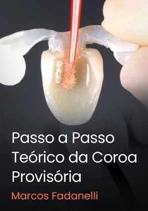 Cover for Passo a Passo Teórico da Coroa Provisória