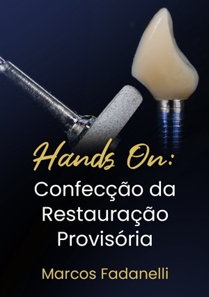 Cover for Hands On: Confecção da Restauração Provisória