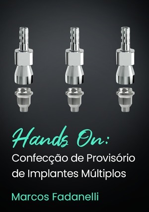 Cover for Hands On: Confecção de Provisório de Implantes Múltiplos