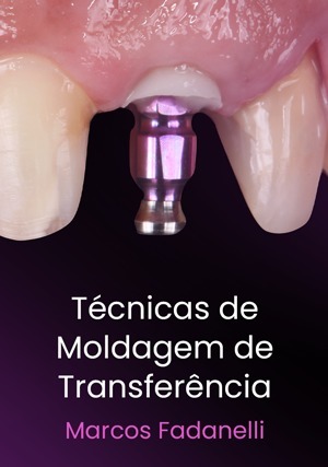 Cover for Técnicas de Moldagem de Transferência