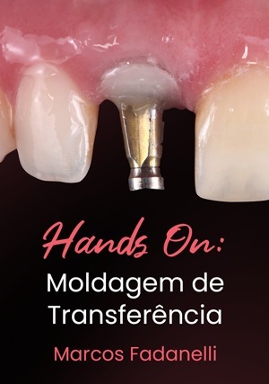 Cover for Hands On: Moldagem de Transferência