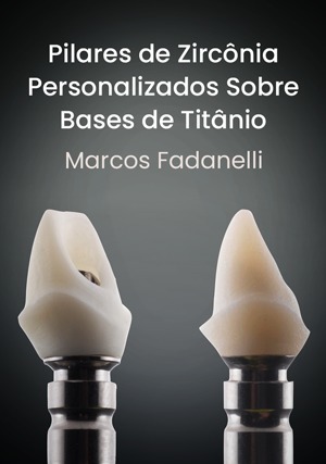 Cover for Pilares de Zircônia Personalizados Sobre Bases de Titânio