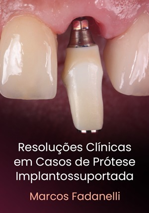 Cover for Resoluções clínicas em casos de Prótese Implantossuportada