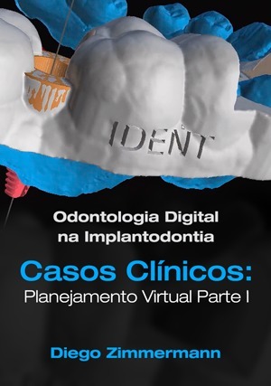 Cover for Odontologia Digital na Implantodontia: Planejamento Virtual Parte I