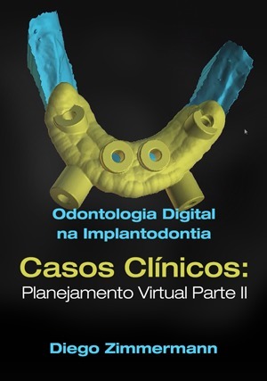 Cover for Odontologia Digital na Implantodontia: Planejamento Virtual Parte II
