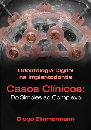 Cover for Odontologia Digital na Implantodontia: Casos Clínicos: Do Simples ao Complexo
